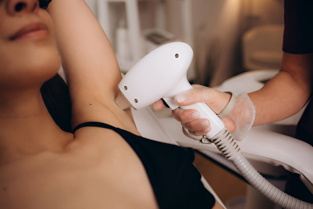 épilation laser toulouse